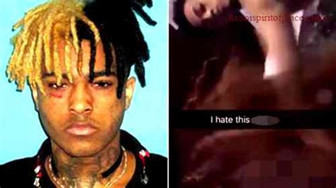 xxx autopsy leak|X’s autopsy : r/XXXTENTACION